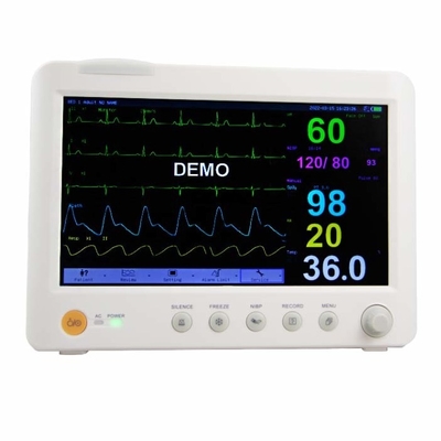 ECG/NIBP มอนิเตอร์ผู้ป่วยแบบพกพาหลายพารามิเตอร์ สําหรับการเก็บข้อมูลภายในโรงพยาบาล