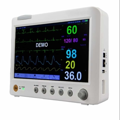 ECG/NIBP มอนิเตอร์ผู้ป่วยแบบพกพาหลายพารามิเตอร์ สําหรับการเก็บข้อมูลภายในโรงพยาบาล