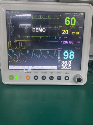 จอภาพผู้ป่วยแบบพกพาพร้อมพารามิเตอร์ของ ETCO2 ECG NIBP SPO2 RESP TEMP PR