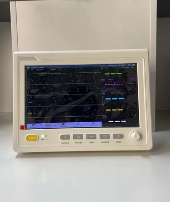 10.1 นิ้ว เครื่อง ECG พกพา สัญญาณสําคัญ ติดตามผู้ป่วย สําหรับการใช้ในโรงพยาบาล