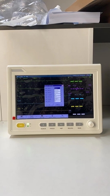 ICU Multiparameter ผู้ป่วย Monitor เครื่องมือโรงพยาบาลอุปกรณ์รถบรรทุกเครื่องมือพกพาเครื่องตรวจสอบสัญญาณสําคัญ