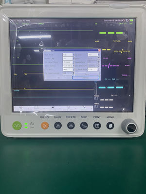 จอภาพผู้ป่วยมัลติพารามิเตอร์ TFT LCD สีขนาด 12.1 นิ้ว พร้อมรับประกัน 1 ปี และดีไซน์กะทัดรัด 30*27*30 ซม.