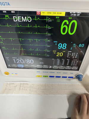 มอนิเตอร์ข้างเตียงแบบพกพาพร้อมกับ EKG SPO2 NIBP TEMP RESP ใบรับประกัน 1 ปี ETCO2 ชั้น II